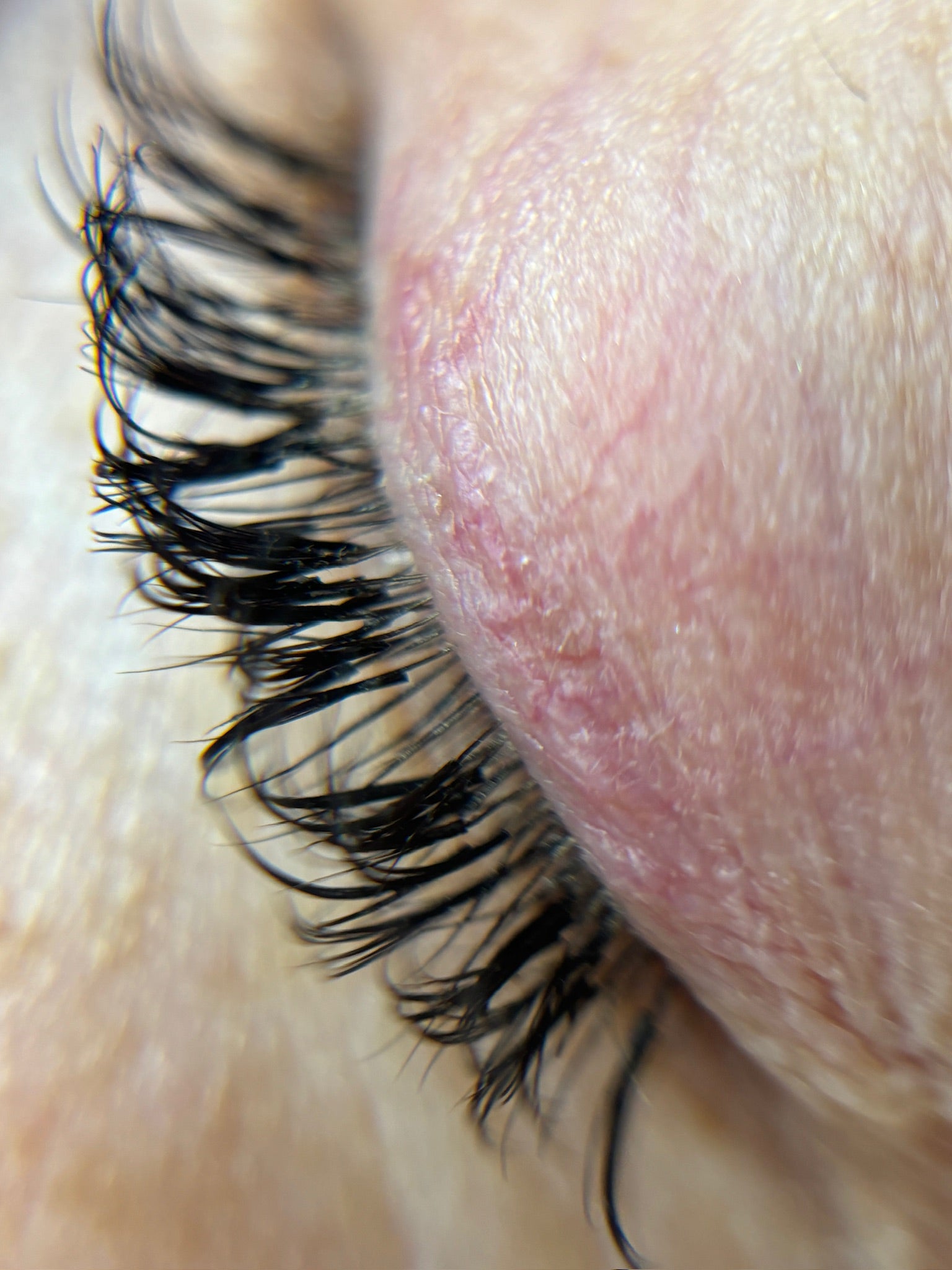 Picture of one closed eye showing eyelash extensions that require a fill. There are gaps where there are no longer any eyelash extensions.