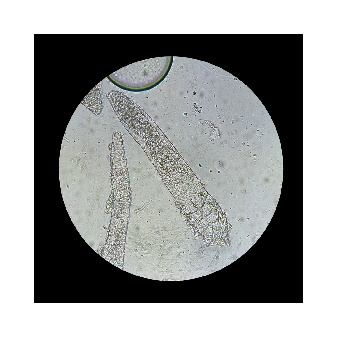 Lash mites (demodex mite) under a microscope.