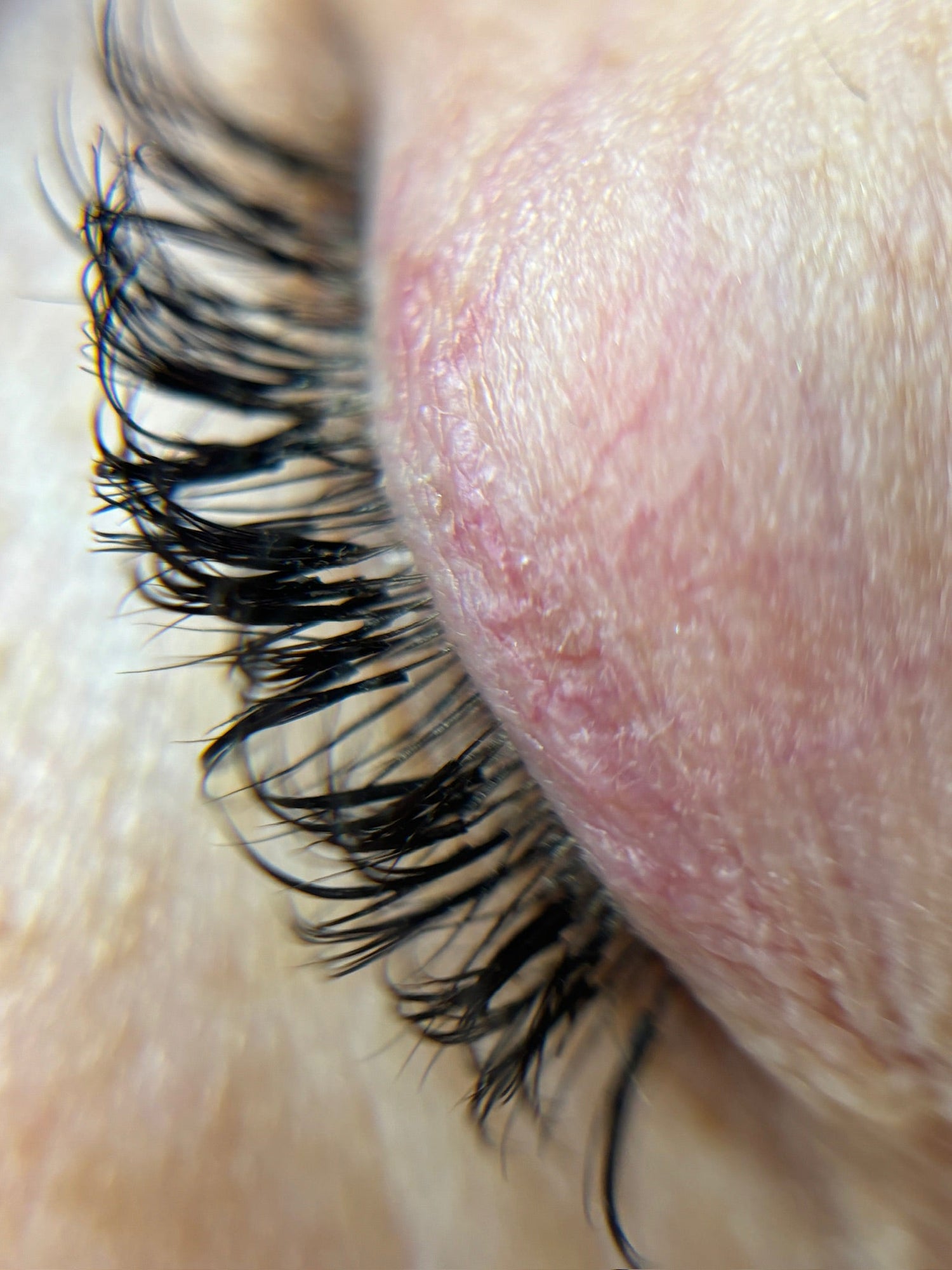 Picture of one closed eye showing eyelash extensions that require a fill. There are gaps where there are no longer any eyelash extensions. 